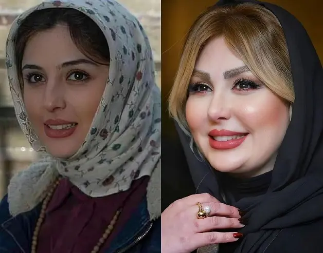 نیوشا ضیغمی | نیوشا ضیغمی همه را شوکه کرد