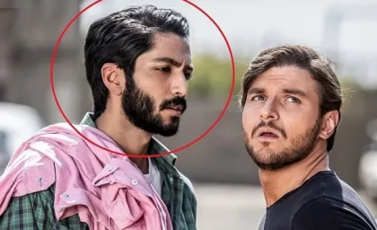 تغییر چهره کیسان دیباج بازیگر سریال از سرنوشت+ عکس | رصد روز