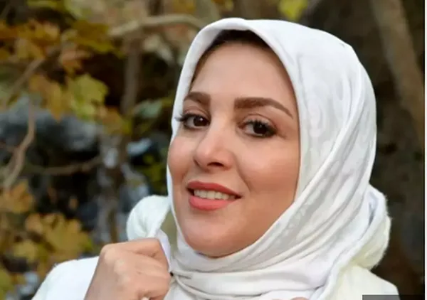 تغییر چهره ژیلا صادقی+ عکس | رصد روز