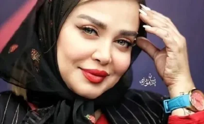 تغییر چهره بهت آور بهاره رهنما در مجارستان+ عکس | رصد روز