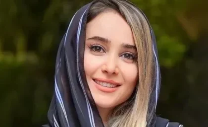 تحول چشمگیر چهره الناز حبیبی بازیگر محبوب ایرانی + عکس