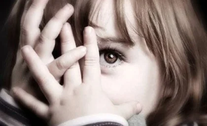 چهره وحشتناک دختری با اجزای صورت نامنظم + عکس