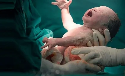 چهره غیر معمول این نوزاد مادرش را شگفت‌ زده کرد + عکس