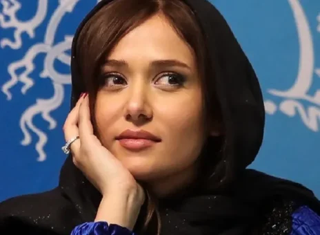 تغییرات چشمگیر چهره بازیگر نقش «جیران» در 38 سالگی