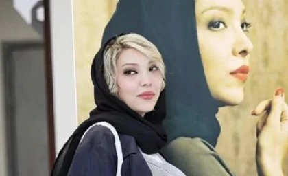 صدف اسپهبدی با صورت خونین در اینستاگرام / چهره وحشتناک خانم بازیگر زیبا در سریال بازنده
