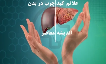 علائم کبد چرب در بدن/زنگ خطر کبد چرب با سبک زندگی ناسالم برای شما فعال شده است!