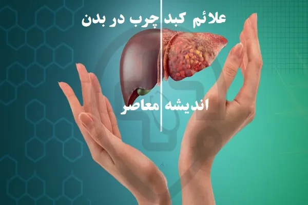 علائم کبد چرب در بدن/زنگ خطر کبد چرب با سبک زندگی ناسالم برای شما فعال شده است!
