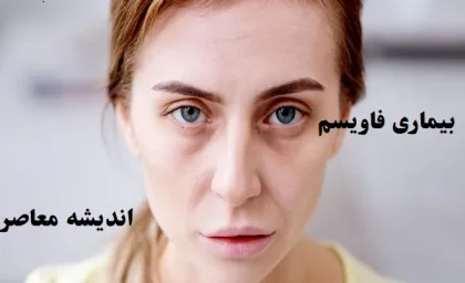 بیماری فاویسم|دنیای خطرناک افراد مبتلا به فاویسم که یک لقمه باقالا می‌تواند جان شما را به خطر بیندازد!