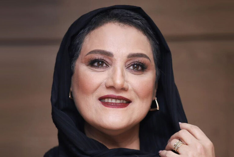 شمایل جدید بازیگر «خجالت نکش» جلب‌توجه کرد