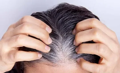 آیا کندن موی سفید باعث زیاد شدن آن می شود ؟