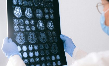 عدم تقارن قلب و مغز: آیا آنها مرتبط هستند؟