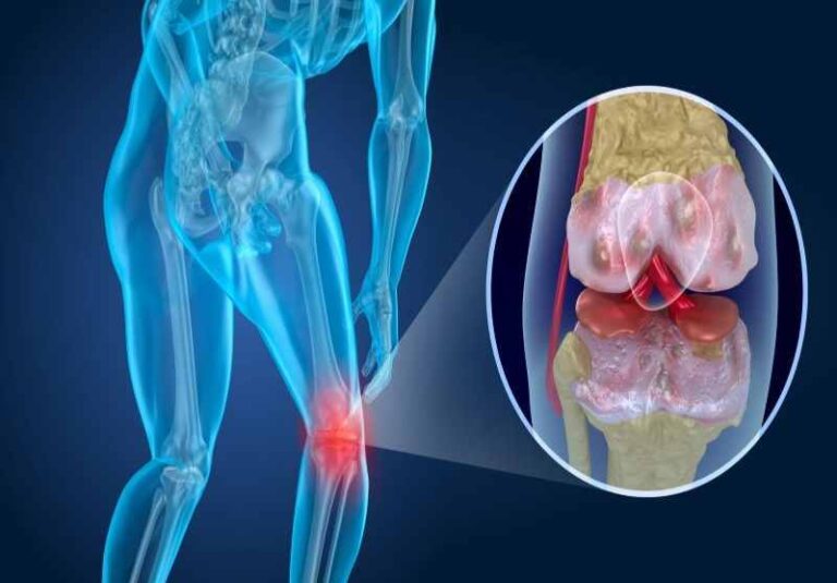 چرا بدن به‌طور طبیعی غضروف‌سازی نمی‌کند؟+فیلم
