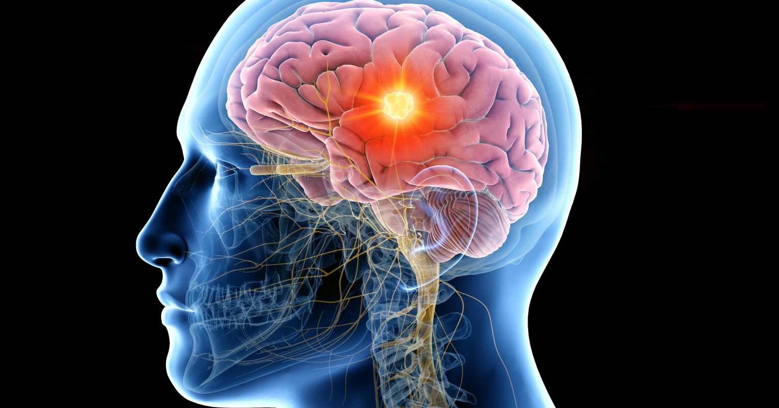 به گفته یک متخصص مغز و اعصاب چهار قدم به سلامت مغز
