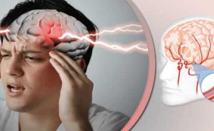 اخبار پزشکی و سلامت از یازده عامل بروز سکته مغزی / اگر این علائم را مشاهده کردید با 115 تماس بگیرید