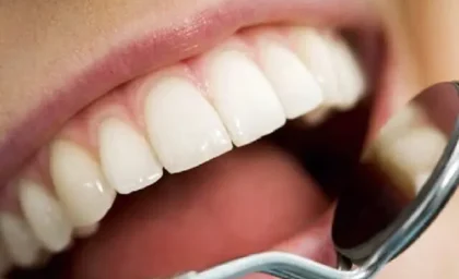 راهنمای مراقبت از دندان‌ها هنگام روزه گرفتن؛ پیشگیری از پوسیدگی و بوی بد دهان / سلامت دهان در رمضان؛ نکات کلیدی برای حفظ دندان‌ها و لثه‌ها در طول روزه‌داری