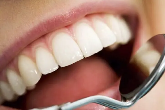 راهنمای مراقبت از دندان‌ها هنگام روزه گرفتن؛ پیشگیری از پوسیدگی و بوی بد دهان / سلامت دهان در رمضان؛ نکات کلیدی برای حفظ دندان‌ها و لثه‌ها در طول روزه‌داری