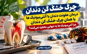 چرک خشک کن دندان | درمان عفونت دندان با آنتی‌ بیوتیک‌ ها یا همان چرک خشک کن دندان / چرا آنتی‌ بیوتیک‌ ها به تنهایی معجزه نمی‌کنند؟