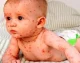 اخبار فوری سلامت | سرخک یکی از مسری ترین بیماری های جهان با قدرت سرایت ۹۰ درصدی ؛ واکسیناسیون به موقع با دو دوز واکسن MMR تنها راه پیشگیری مؤثر است / هشدار وزارت بهداشت : کاهش پوشش واکسیناسیون در برخی مناطق کشور، خطر شیوع مجدد این بیماری را افزایش داده است